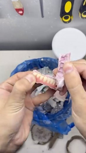 Check the profile and other videos Dental implants #dentalife #asmr #candulor #съемныепротезы #зубнойтехник #dentaltechnician #dentallab #зуботехническаялаборатория #dentalmemes #dentalstudent #dentalmalaysia #canduloraesthetic #dentallaboratory #dentallab #зубтехник #зуботехническаялаборатория #съемныепротезы | dentistrysocial