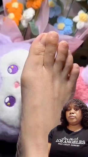 This silicone big toe corrector | Selebrities update