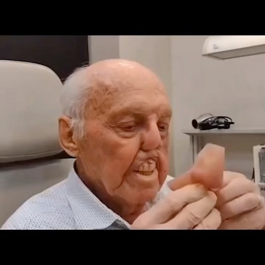 Doctor Smile on Instagram: "Trying out a prosthetic nose 👃. Try-in done at Huntsman Cancer Hospital by professor Paul Tanner. A nasal prosthesis is fabricated in order to restore the anatomical contour of the nose and improve function for patients who have experienced partial or total loss of the nose due to trauma or disease/cancer. It is typically made of soft silicone to smoothly adjust to the nasal defect. Some nasal defects may extend into the cheek, forehead, upper lip region or the mouth