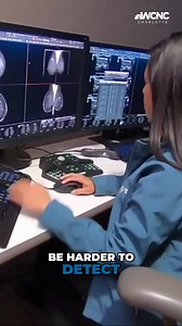 Breast cancer's hidden challenge: Lobular carcinoma risks