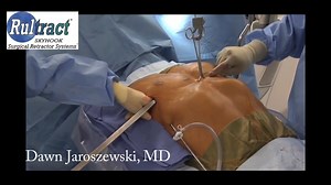 Pectus Excavatum Repair NUSS Dr Jaroszewski
