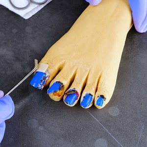 218K views · 187 reactions | No More Rotten or Smelly Teeth | Transformazing | Facebook