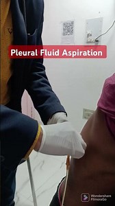 Pleural Effusion Tapping ll Chest Specialist in patna ll Dr Sanjay kumar #chestclinic