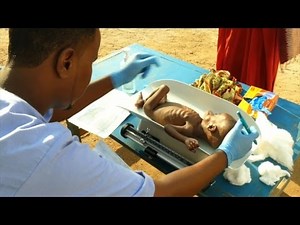 Malnutrition at record high in drought-hit Somalia: ICRC