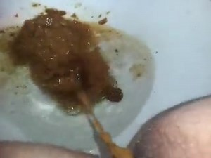 runny shit between legs 1