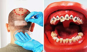 Amazing medical procedures on mock-ups of human parts | Crafty Gadgets