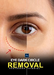 Just 30 Sec! Remove Dark Eye Circle in Photoshop | Photoshop Shorts #darkeyecircles #eyecircles #eye #darlcirclesremove #photoshoptutorial #adobephotoshop #photoshopediting #tutorial #shortsvideo #adobe #photoshop #adobephotoshop #adobephotoshop2024 #adobephotoshopcc2019 | Graphics Solution Tricks