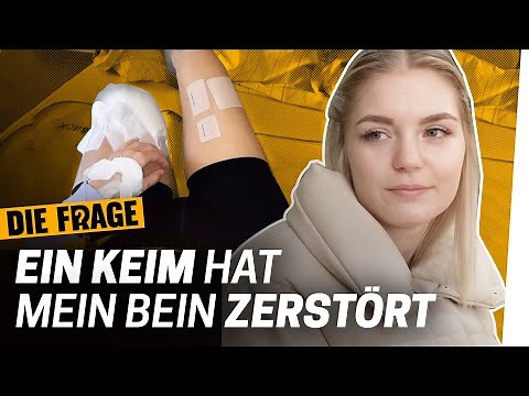 Amputation: 33 Operationen konnten mein Bein nicht retten | Wie komme ich mit meinem Körper klar? #6