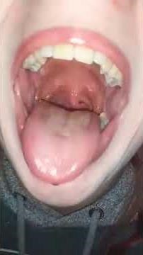 Swallowing peas whole