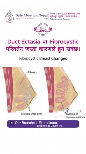 Understanding Nipple Discharge Causes and Symptoms