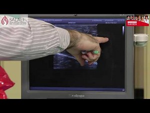 Ultrasound guided biopsy: "How you do it"