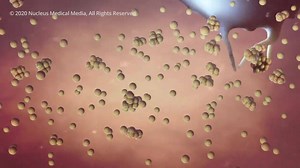 2.3K views · 68 reactions | COVID-19: What Happens If You Get Coronavirus? | Patient Aid | Facebook