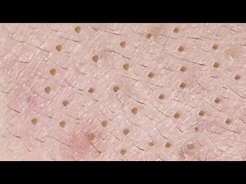 Satisfying Relaxing with Sac Dep Spa Video (#257) #SacDepSpa