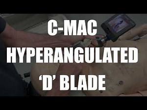 Hyperangulated Videolaryngoscopy: What is it? How do you use it?