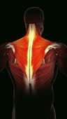 Common symptoms of trapezius muscle pain or injury includePain or...