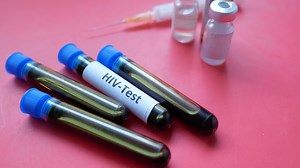 Download Lab vials of blood for HIV testing for free