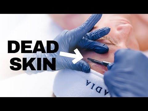 The Skin Benefits of Dermaplaning