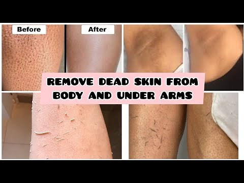 HOW TO: EXFOLIATE / REMOVE DEAD SKIN & PREVENT STRAWBERRY LEGS