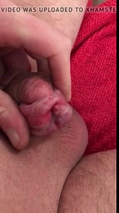 Stretching my split glans penis 2