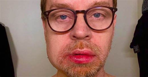 'Woke up in a pool of blood': Darren Hayes shares near-death experience