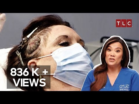 A Head Full of Worries! | Dr Pimple Popper TLC