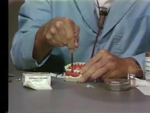 Blood Coagulation Techniques and Hemostasis in Oral Surgery