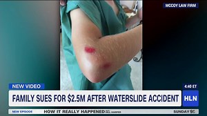 New video & photos: Family sues California city for $2.5 million after 10-year-old boy was injured in waterslide accident. | Michaela Pereira