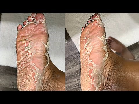 I TRIED A CRAZY FOOT PEEL MASK *INSANE RESULTS* 😳😳😳