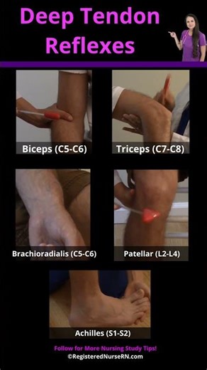 Deep Tendon Reflexes in 8 Seconds #nursing #nurse #nclex