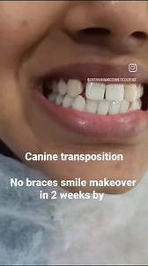 All Smiles Dental Clinic,Bangalore-center for cosmetic dentistry on Reels | Facebook