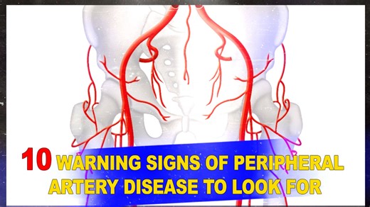 10 Warning Signs of Peripheral Artery Disease To Look Out For