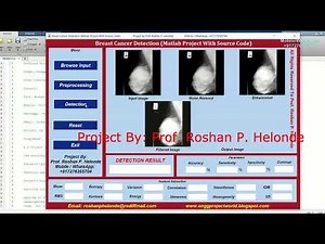 Breast Cancer Detection Using Image Processing | Breast Cancer Classification Using Matlab Project