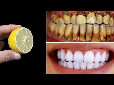 How to Whiten Yellow Teeth in 2 Minutes (Baking Soda & Lemon) 🦷✨
