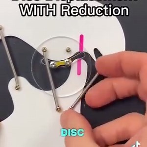 Explicado el desplazamiento de ATM 🎞 skylinept . . #odontologoscolombianos #odontologia #dentista #odonto #ortodoncia #odontologiaestetica #odontopediatria #prostodoncia #ortopediadental #odontologo #endodoncia #implantes #maxilofacial #odontologoscol #dentalelectronico #edent #colombia | Odontologos.com.co