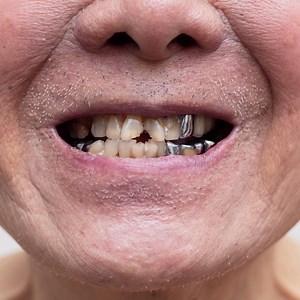 Tune into the latest Dental Files episode, Managing complex and...