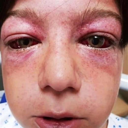 11-year-old found unconscious and ”looking like an alien”, then mom learns horrific truth and shares a warning for all parents...Check comments 👇🏻😢 | Moms Behaving Badly