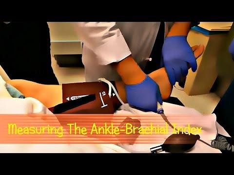 Measuring the Ankle-Brachial Index