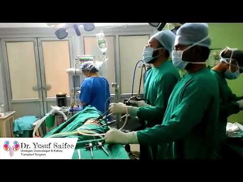 Laparoscopic kidney surgery | Dr Yusuf Saifee