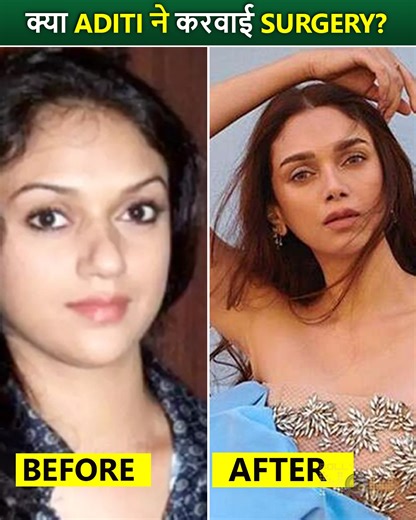 Aditi Rao Hydari, who is currently enjoying the success of her role of Bibbojaan in Heeramandi: The Diamond Bazaar, However, now, the actress has caught the attention of her fans with her shocking beauty transformation. Netizens Say 'Money Can Buy Beauty' | Bollywood Now