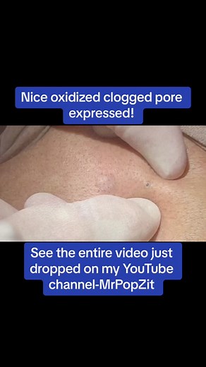 Dermatologist Reveals Effective Pore Care Techniques