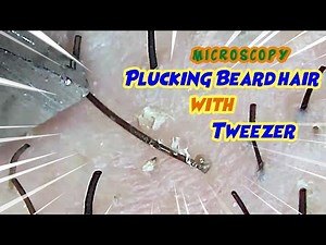 Plucking Beard Hair (Amazing zoom) Hair removal #8