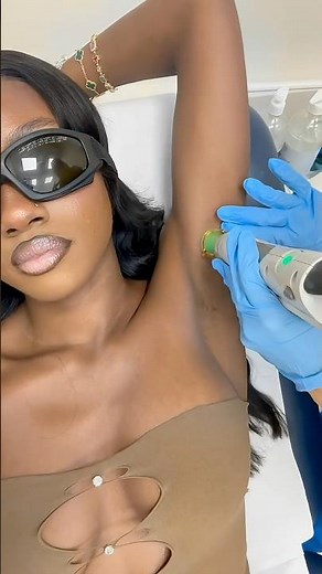 Best Decision Ever! Laser Hair Removal Results That Shocked Me