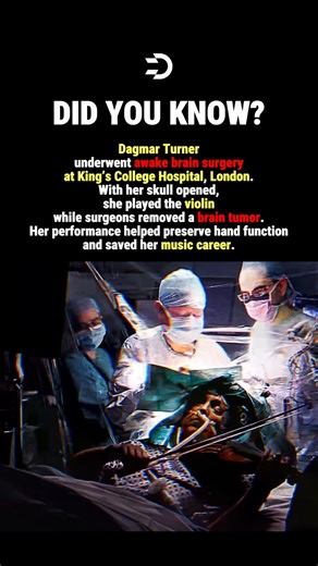 She Played During BRAIN Surgery #history #facts