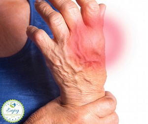 Best Essential Oils for Arthritis - 5 Best Essential Oils for Arthritis Pain & Inflammation (+ Pain Relief Recipes) - Enjoy Natural Health