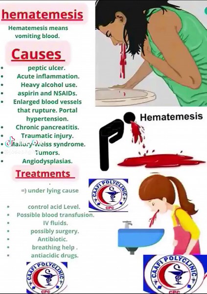 Understanding Hematemesis: Causes, Treatments, and Pictures