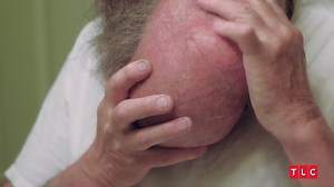 Tim's facial tumor has been growing for nearly 20 years, the weight dragging down his face and neck. Now he's ready for a big improvement! Don't miss #TakeMyTumor Wednesday at 10/9c. | TLC
