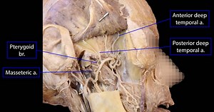 Infratemporal Fossa 12.JPG