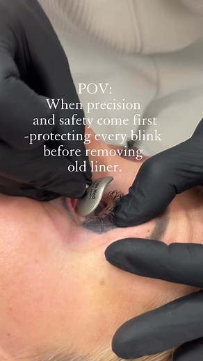 🔹 Laser eyeliner removal in progress…🔹 Safety first! Shielding the eye before the treatment.🔹 Say goodbye to old PMU with confidence.Curious about laser PMU removal? 📩 DM me for details!📲07553546182 | Gina G Beauty • PMU & Aesthetic Clinic