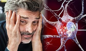Parkinson's disease: The signs and symptoms