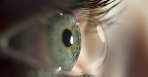 Toric Peripheral Curves in Ortho-K Lenses: Ensuring Stability and Comfort for Toric Patients – Archyde